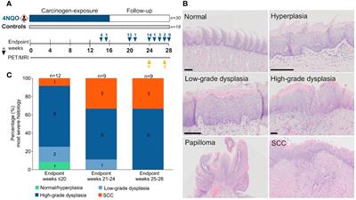 4-nitroquinoline 1-oxide-induced oral epithelial lesions exhibit time- and stage-dependent changes in the tumor immune microenvironment